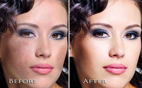 Face Blemishes Removal 1.6 Apk + Mod for Android 5