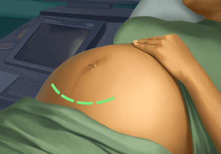 Operate Now Hospital – Surgery 1.51.0 Apk for Android 2