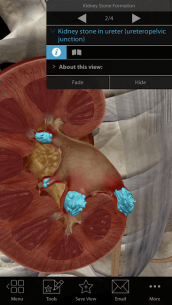 Physiology & Pathology 1.0.11 Apk + Data for Android 4