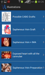 Vargo Anesthesia Mega App 19.0 Apk for Android 3